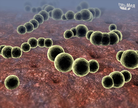 Пневмококк (Streptococcus pneumoniae) частый возбудитель пневмонии